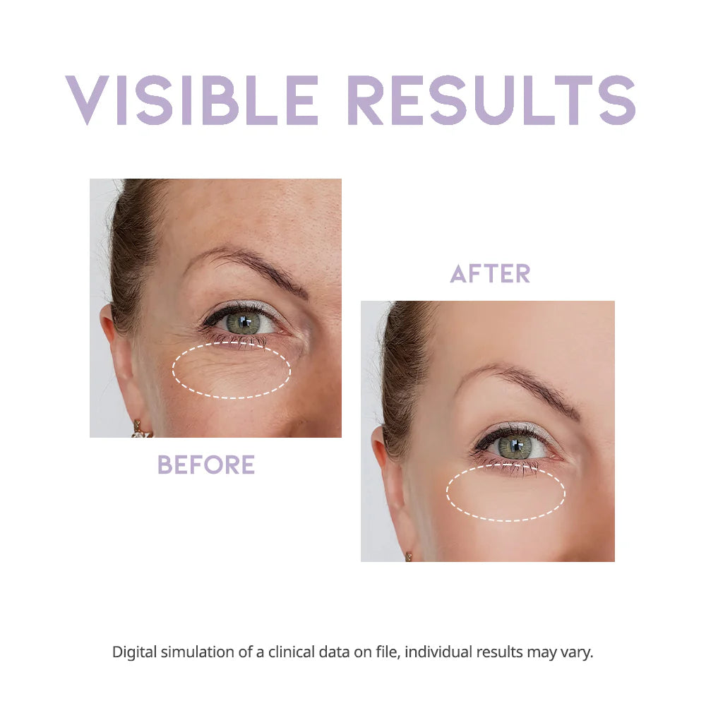 OOTD - OVERNIGHT EYE CREAM