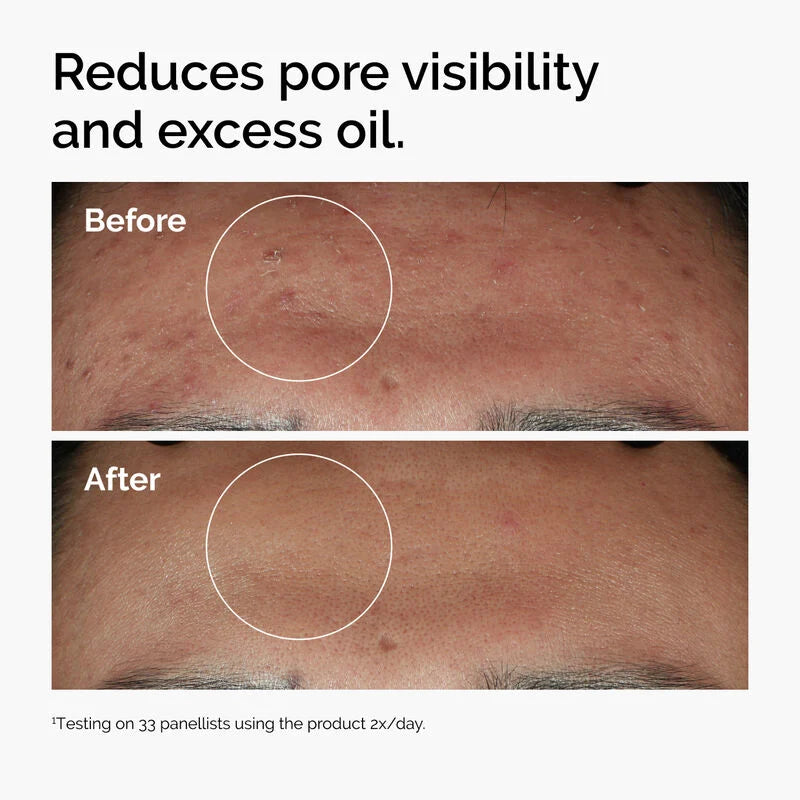 The Ordinary - NIACINAMIDE 10% + ZINC 1% 30ML