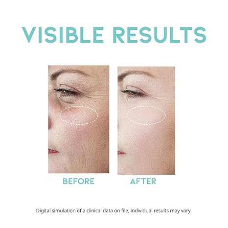 OOTD - WRINKLE LIFT RETINOL SERUM