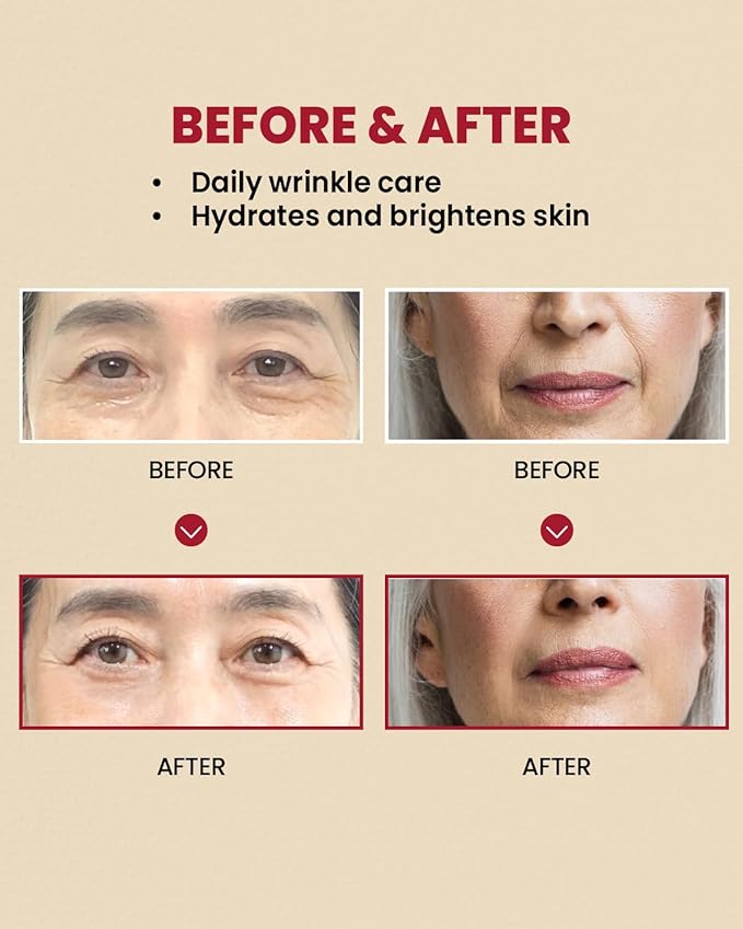 KSECRET SEOUL 1988 CREAM : RETINAL LIPOSOME 1% + FERMENTED RICE
