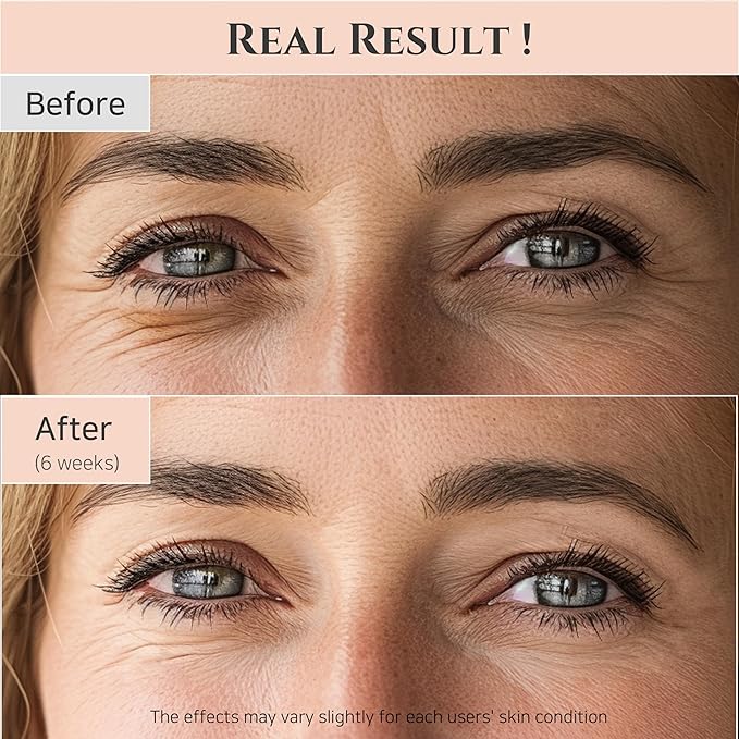 Beauty of Joseon - REVIVE EYE SERUM : GINSENG + RETINAL