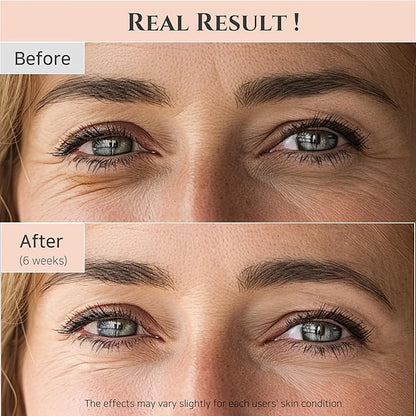 Beauty of Joseon - REVIVE EYE SERUM : GINSENG + RETINAL