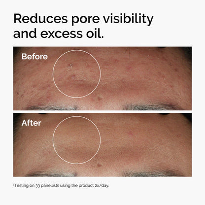 The Ordinary - NIACINAMIDE 10% + ZINC 1% 30ML